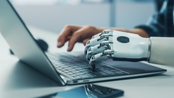 Close-up on Hands: Person with Disability Using Prosthetic Arm to Work on Laptop Computer. Specialist Swift and Natural Use of Thought Controlled Body Powered Myoelectric Bionic Hand.