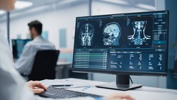Medical Hospital Research Lab: Caucasian Female Neurosurgeon Using Computer with Brain Scan MRI Images, Finding Best Treatment for Sick Patient. Professional Neurologist is using CT Scan