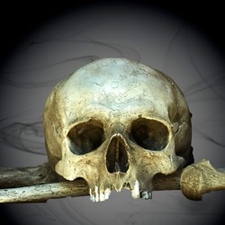 Upper part of skull of human lying on thigh bone against abstract background with black smoke clouds