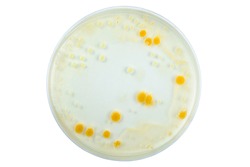 Petri dish and culture media with bacteria on white background with clipping, Food science.