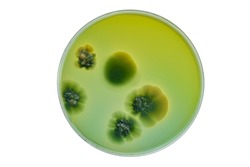 Petri dish and culture media with bacteria on white background with clipping, Test various germs, virus, Coronavirus, Corona, COVID-19, Microbial population count, Food science.