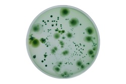 Colonies of different bacteria and mold fungi grown on Petri dish with nutrient agar, Test various germs, virus, Coronavirus, Corona, COVID-19, Microbial population count. Food science.