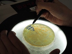 Bacterial colony counting in close up