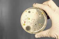 Gloved hand holding a Petri dish with bacteria culture