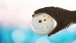 Gloved hand holding a Petri dish with bacteria culture