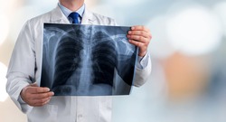 Doctor holding radiography x ray photo on hospital background