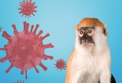 Monkeypox outbreak, MPXV virus, infectious disease spreading, zoonotic disease.