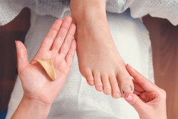 Orthopedist shows a silicone impression on the hand to correct an ingrown toenail on the client's big toe. Close-up. Top view. The concept of podology and chiropody.