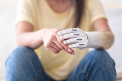 Close up two hands of woman with bionic arm, person lost her arm, girl artificial prosthetic limb