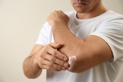 Man applying cream onto elbow on beige background, closeup