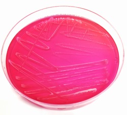 Staphylococcus epidermidis on Mannitol Salt Agar(MSA)
