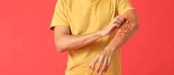 Man ill with monkeypox scratching his arm on red background