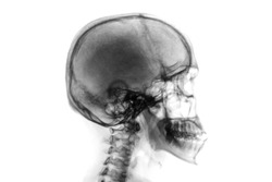 X-ray normal skull and cervical spine . Lateral view . Invert color style .