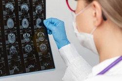 MRI scan of brain by computer tomography in the doctor's hands. A young blonde female doctor examining MRI scan of head and brain of patient on a white background. Selective focus. Close-up