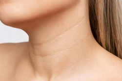 Сlose-up of a young blonde woman's neck  on a white background. Lines on the neck. Wrinkles, age-related changes, rings of Venus, goosebumps. Skin care