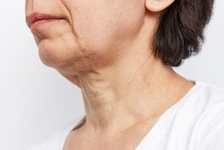 The lower part of elderly woman's face and neck with signs of skin aging isolated on a white background. Age-related changes, flabby sagging facial skin. Cosmetology and beauty concept