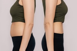 Young woman in profile with a belly with excess fat and toned slim stomach with abs before and after losing weight isolated on a beige background. Result of diet, liposuction, training