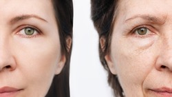 Comparison of the face of young and aged women. Youth, old age. The process of aging and rejuvenation, the result years later. Beauty treatments and lifting. Age-related changes,appearance of wrinkles