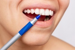 Cropped shot of a young woman pointing to white spots on the tooth enamel with a pen. Oral hygiene, dental health care. Dentistry, demineralization of teeth, enamel hypoplasia, fluorosis