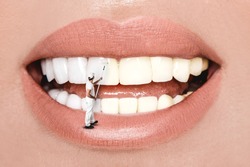 Laughing woman mouth with great teeth over white background. Whitening concept. Dentistry.