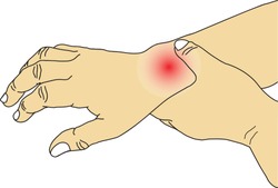 Vector illustration drawing of people with wrist pain