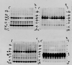 Skan of western blotting film with an image of four membranes subjected to antibodies recognizing different protein species visible as black stops or blots