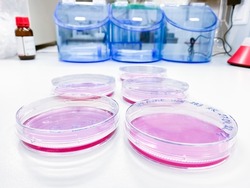 Several cell culture dishes in a laboratory. Cells cultured in vitro are commonly used for biocompatibility evaluation when new medical devices enter the market.