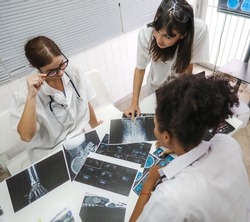 Diverse female doctors look at medical x-ray then diagnose and discuss before surgery at hospital. Surgeon and radiologist teamwork talking, analysis x-ray film before treatment. Selective Focus.