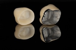 The base intaglio surface comparison between full zirconia crown and a metal ceramic/porcelain jacket dental crown with a dark background and reflection