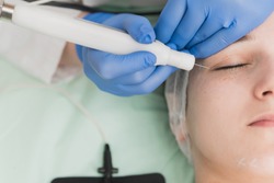 Closeup cropped image of female patient having treatment with plasma pen for firming eyelids