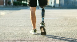 Low angle view at disabled young man with prosthetic leg walking along the street