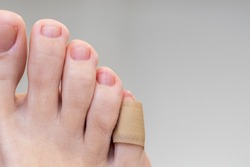 Medical plaster on the female little toe. Wound at toe