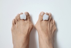 Soft defocused photo of a pair of bunion feet wearing toe separators closed up on off white background. Photo is soft focused with some blur parts