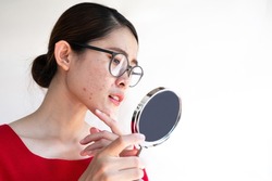 Portrait of worried Asian woman with bad emotional while looking acne and scar occur on her face by mini mirror. Conceptual shot of Acne and Problem Skin on female face.