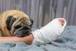 The pug laid his head on the owner's foot. Human foot in a cast. The dog shows pity and compassion.