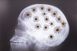 X-ray of the bones of the skull, with white daisies filled in the picture. Medical concept. Flowers and x-ray of the skull. Flowers in the head, with a background on ideas