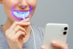 A woman holds in his hand an ultraviolet lamp for home teeth whitening. A snow-white smile after bleaching.