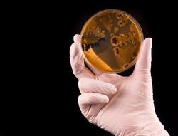 Scientist's hand holding petri dish infected with Salmonella bacteria on black background