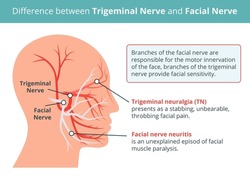 Trigeminal Nerve and Facial Nerve. Difference between Trigeminal Neuralgia and Facial Nerve Neuritis. Simple vector anatomy illustration in flat style.
