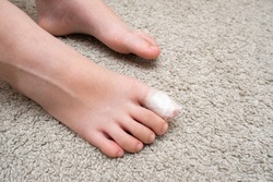 Kid teenager bare foot with a bandage on a toe, wounded toe or ingrown nail first aid.