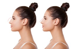 Comparison of Female Nose after Plastic Surgery. Caucasian young Woman in Profile is isolated on white background       
