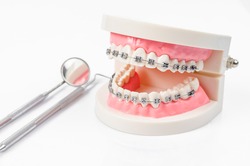 tooth model with metal wire dental braces and mirror dental equipment isolated on white background.