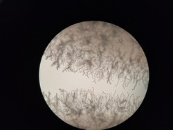 Microscopic observation of microbial colonies