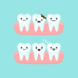 Dental filling on a broken tooth stomatology concept. Cute cartoon vector teeth isolated illustration