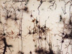 Mouse brain section stained with the Golgi stain, a 19th century technique that was  widely used until recently -  and occasionally still is.  Neurons and some vessel fragments in the cerebral cortex.
