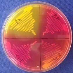 Staphylococcus grown on Mannitol Salt Agar. Pink represents coagulase negative Staphylococcus and yellow represents coagulase positive Staphylococcus			