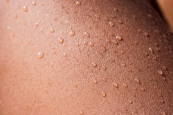 Water drops on human skin in macro view