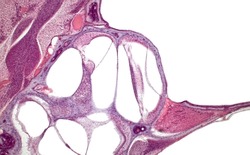 Inner ear cochlea histology. Organ of Corti (spiral organ). Haematoxylin and eosin stain. 
