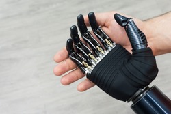 Bionic hand. Prosthetic human limbs. Manufacturing of artificial limbs from carbon.