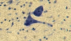 Neurons with processes under a microscope. Nervous tissue micropreparation